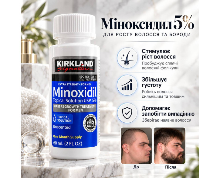 Kirkland Signature Міноксидил 5% лосьйон 1 флакон 60 мл