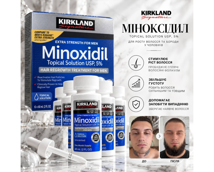 Kirkland Signature Міноксидил Лосьйон 5% 6 флаконів по 60 мл