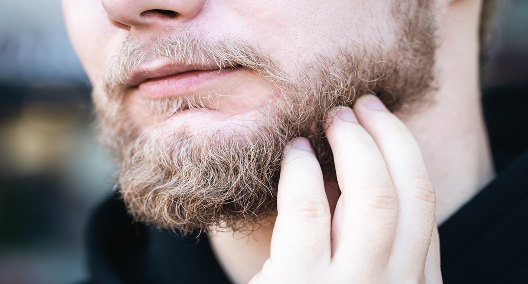 Лупа в бороді та вусах: причини появи, способи боротьби