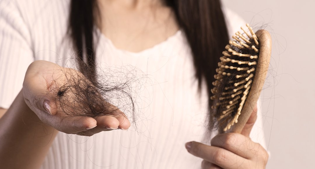 Випадіння волосся у жінок: Поради трихолога