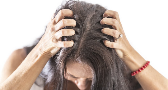 Суха шкіра голови – основні причини, лікування